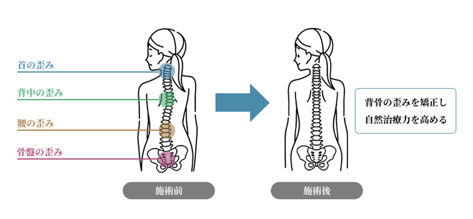 歪み施術イメージ